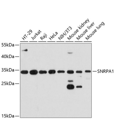 SNRPA1 Rabbit Polyclonal Antibody