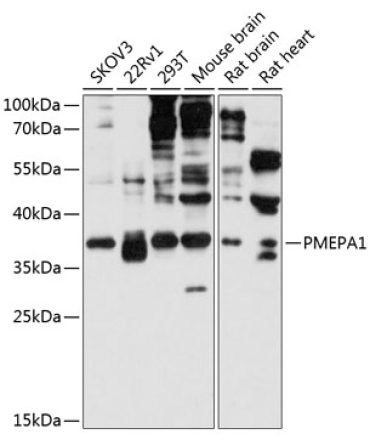 PMEPA1 Rabbit Polyclonal Antibody