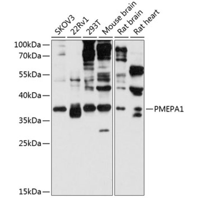 PMEPA1 Rabbit Polyclonal Antibody