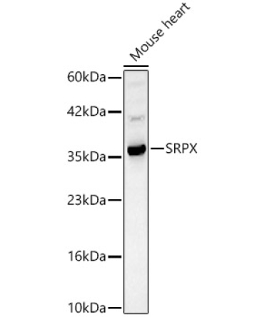 SRPX Rabbit Polyclonal Antibody