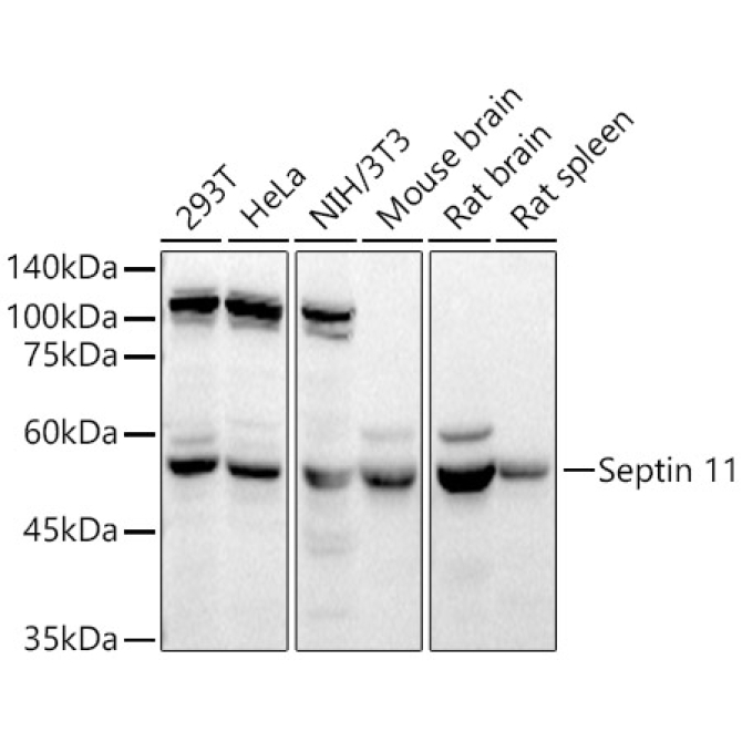 Septin 11 Rabbit Polyclonal Antibody