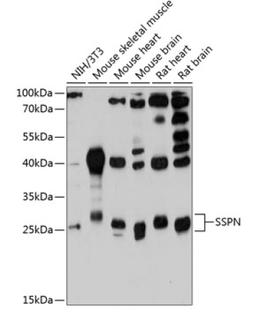 SSPN Rabbit Polyclonal Antibody