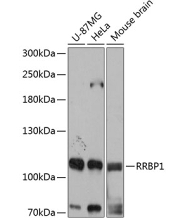 RRBP1 Rabbit Polyclonal Antibody