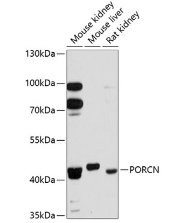 PORCN Rabbit Polyclonal Antibody