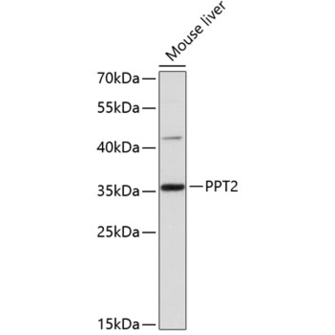 PPT2 Rabbit Polyclonal Antibody