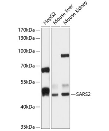 SARS2 Rabbit Polyclonal Antibody