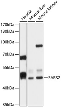 SARS2 Rabbit Polyclonal Antibody