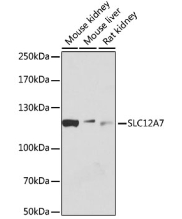 SLC12A7 Rabbit Polyclonal Antibody
