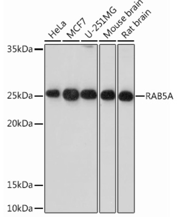 RAB5A Rabbit Monoclonal Antibody