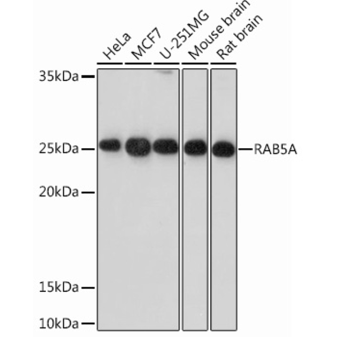 RAB5A Rabbit Monoclonal Antibody