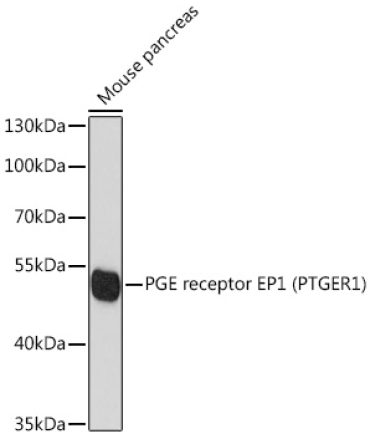 PGE receptor EP1 (PTGER1) Rabbit Polyclonal Antibody