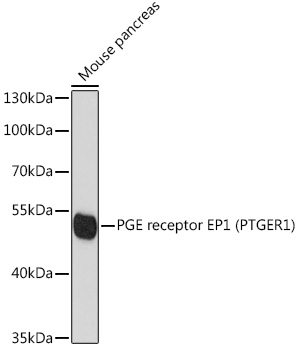 PGE receptor EP1 (PTGER1) Rabbit Polyclonal Antibody