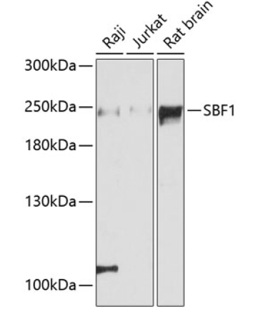 SBF1 Rabbit Polyclonal Antibody