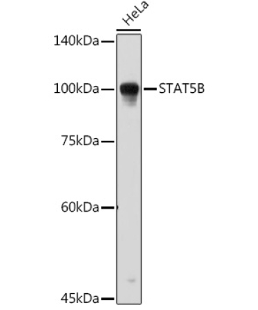 STAT5B Rabbit Polyclonal Antibody