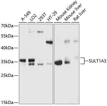 SULT1A3 Rabbit Polyclonal Antibody