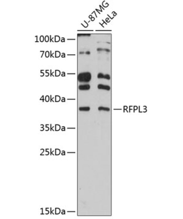 RFPL3 Rabbit Polyclonal Antibody