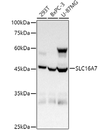 SLC16A7 Rabbit Polyclonal Antibody