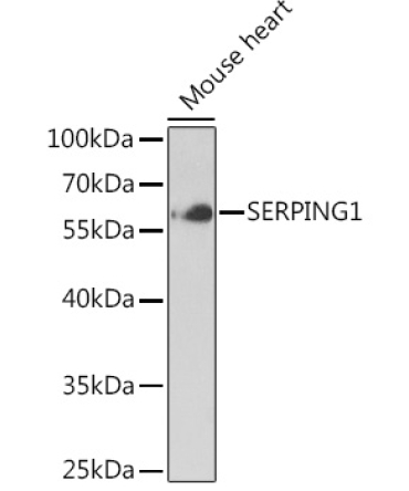 SERPING1 Rabbit Polyclonal Antibody