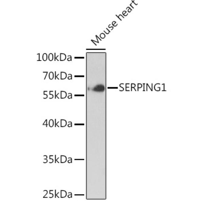SERPING1 Rabbit Polyclonal Antibody
