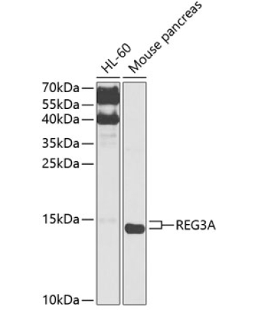 REG3A Rabbit Polyclonal Antibody