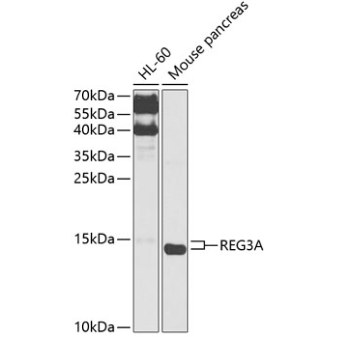 REG3A Rabbit Polyclonal Antibody
