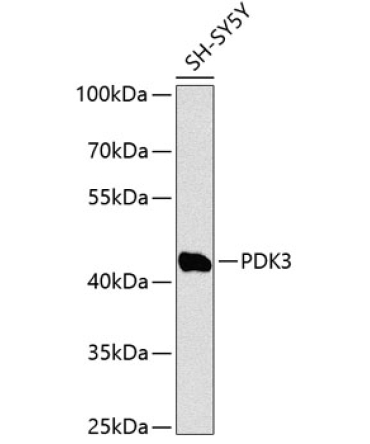 PDK3 Rabbit Polyclonal Antibody