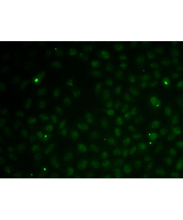 RAD51C Rabbit Polyclonal Antibody