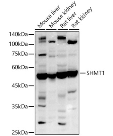 SHMT1 Rabbit Polyclonal Antibody