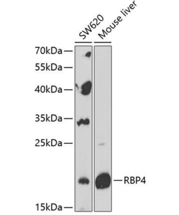 RBP4 Rabbit Polyclonal Antibody