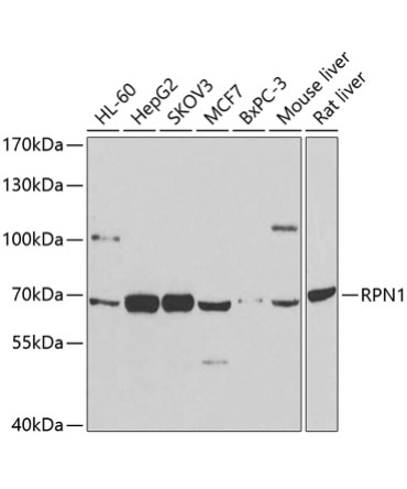 RPN1 Rabbit Polyclonal Antibody