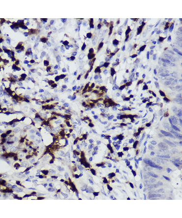 S100A12 Rabbit Polyclonal Antibody