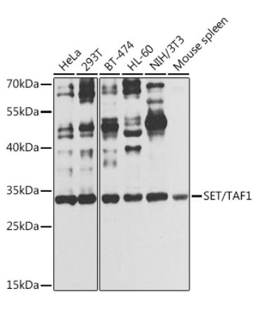 SET/TAF1 Rabbit Polyclonal Antibody