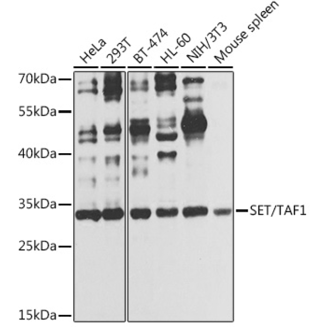 SET/TAF1 Rabbit Polyclonal Antibody