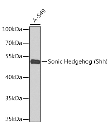 Sonic Hedgehog (Shh) Rabbit Polyclonal Antibody