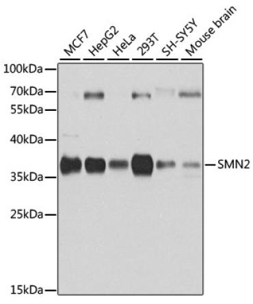 SMN2 Rabbit Polyclonal Antibody