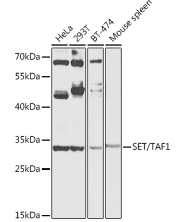 SET/TAF1 Rabbit Polyclonal Antibody