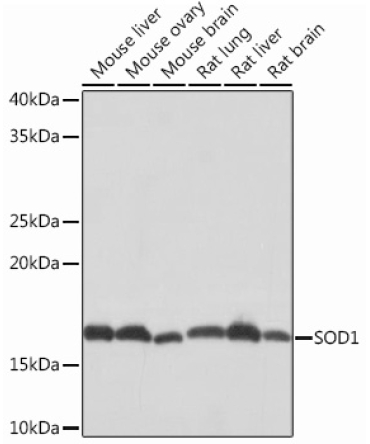 SOD1 Rabbit Monoclonal Antibody