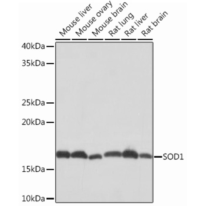 SOD1 Rabbit Monoclonal Antibody
