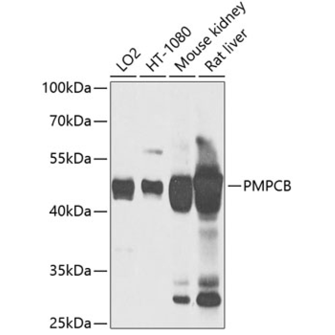 PMPCB Rabbit Polyclonal Antibody
