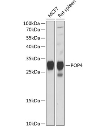 POP4 Rabbit Polyclonal Antibody