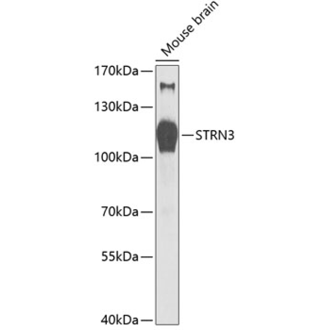STRN3 Rabbit Polyclonal Antibody