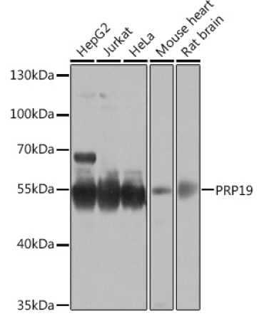 PRP19 Rabbit Polyclonal Antibody