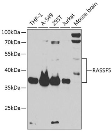 RASSF5 Rabbit Polyclonal Antibody