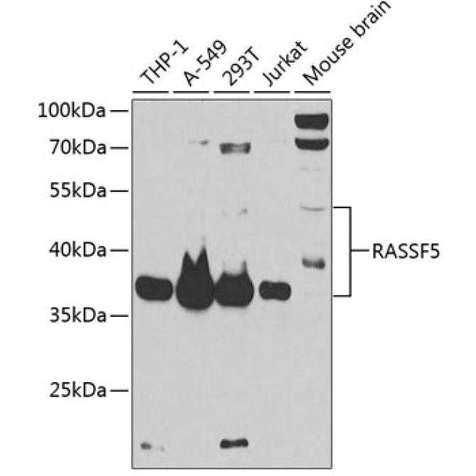 RASSF5 Rabbit Polyclonal Antibody