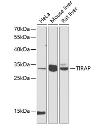 TIRAP Rabbit Polyclonal Antibody