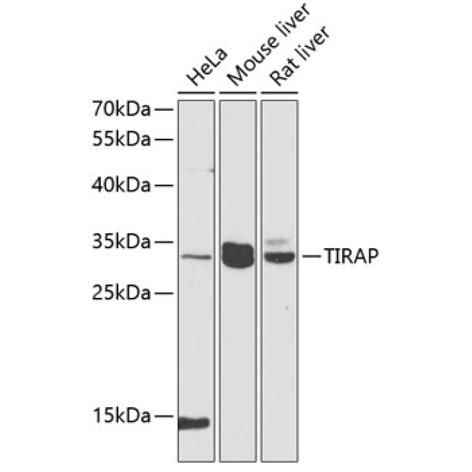 TIRAP Rabbit Polyclonal Antibody