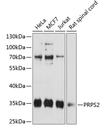 PRPS2 Rabbit Polyclonal Antibody