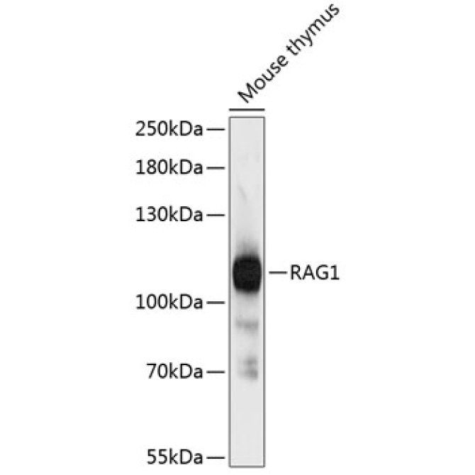 RAG1 Rabbit Polyclonal Antibody