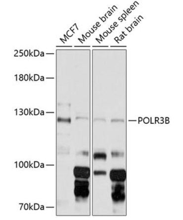 POLR3B Rabbit Polyclonal Antibody