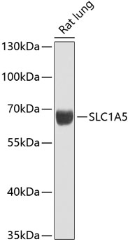 SLC1A5 Rabbit Polyclonal Antibody